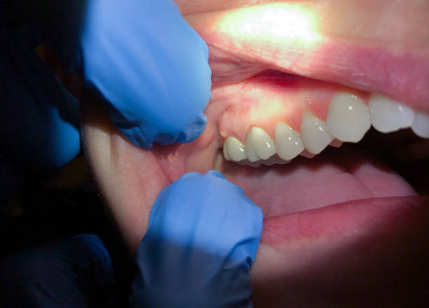 Best Pediatric Emergency Dentist in La Croft, OH